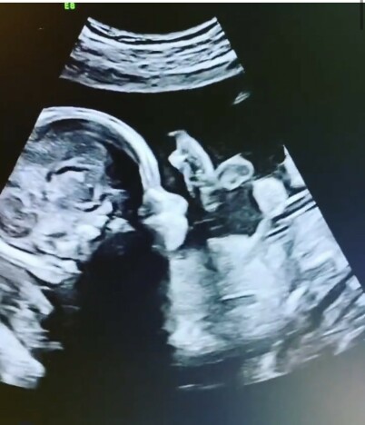 2020: Den lille babyen kommer til verden seinere i år, bekrefter paret. Foto: Privat 2020: Den lille babyen kommer til verden seinere i år, bekrefter paret. Foto: Privat